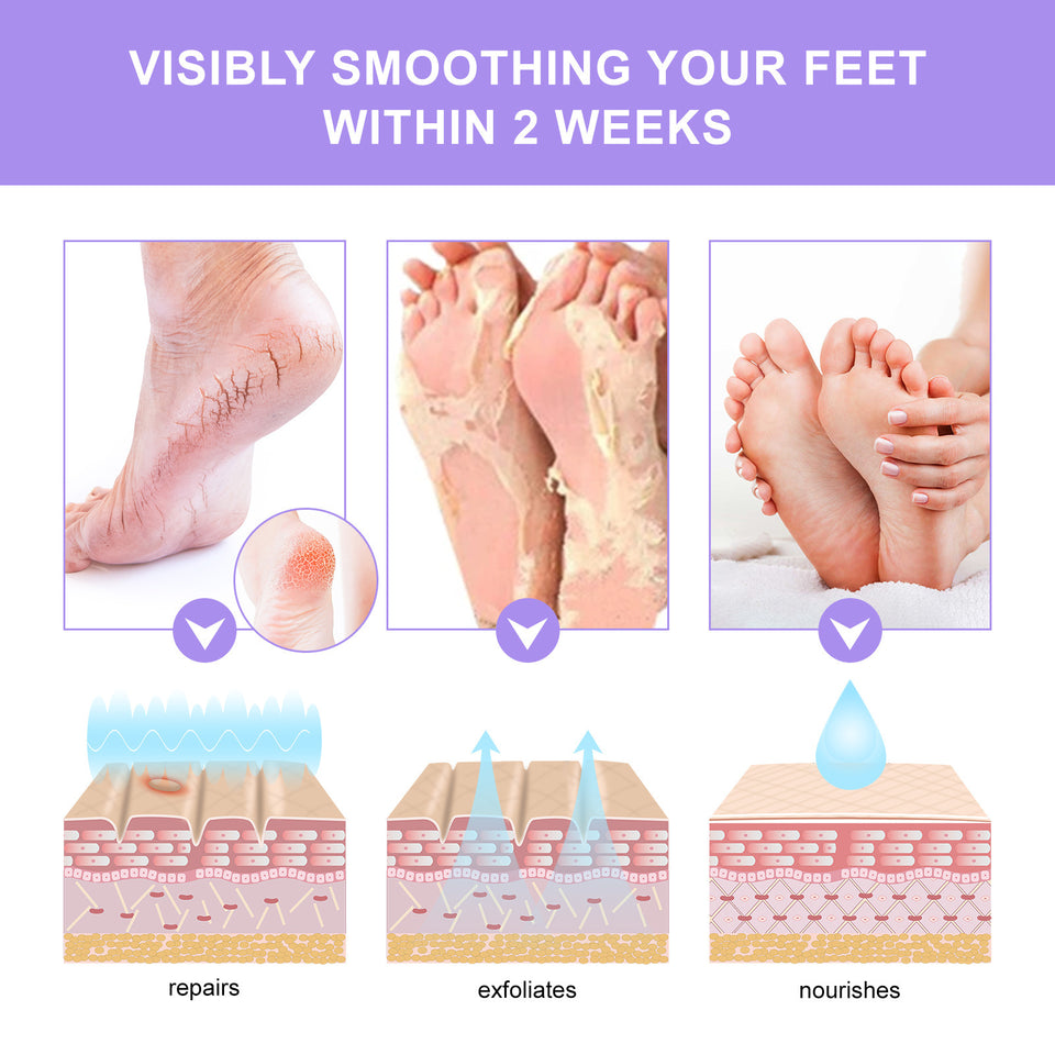 Exfoliating Foot Mask Feet Cream For Dead Skin Removal Foot Care Tool Removing Dead Skin Foot Peeling Whitening Foot