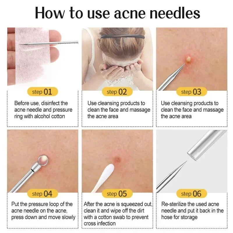 11Pcs Acne Needle Professional Tweezers Acne Remover Ultra-fine No. 5 Cell Pimples Blackhead Clip Facial Pore Cleaning Care Tool