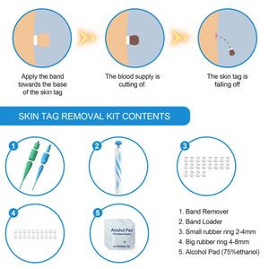 2 In 1 Auto Micro Skin Tag Remover Device Portable Skin Tag Removal Kit Adult Mole Stain Wart Corn Remover Face Care Beauty Tool