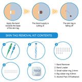 2 In 1 Auto Micro Skin Tag Remover Device Portable Skin Tag Removal Kit Adult Mole Stain Wart Corn Remover Face Care Beauty Tool