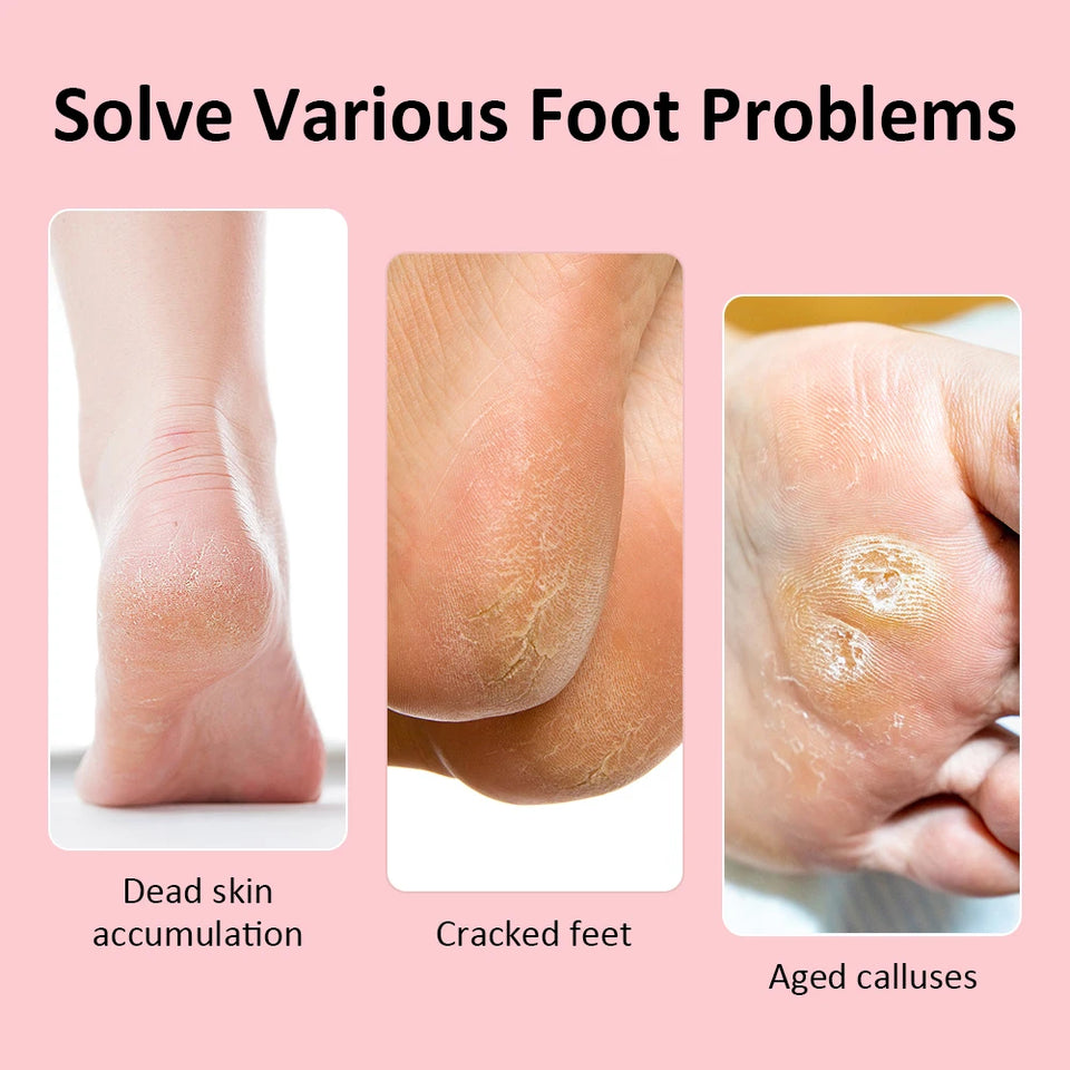 Wireless Foot Care File Leg Heels Remove USB Rechargeable Dead Skin Pedicure Tool with Replacement Sandpaper Foot Care Tool