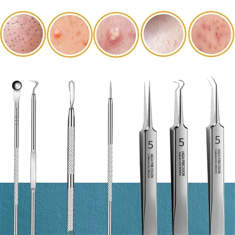 11Pcs Acne Needle Professional Tweezers Acne Remover Ultra-fine No. 5 Cell Pimples Blackhead Clip Facial Pore Cleaning Care Tool