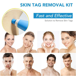 2 In 1 Auto Micro Skin Tag Remover Device Portable Skin Tag Removal Kit Adult Mole Stain Wart Corn Remover Face Care Beauty Tool
