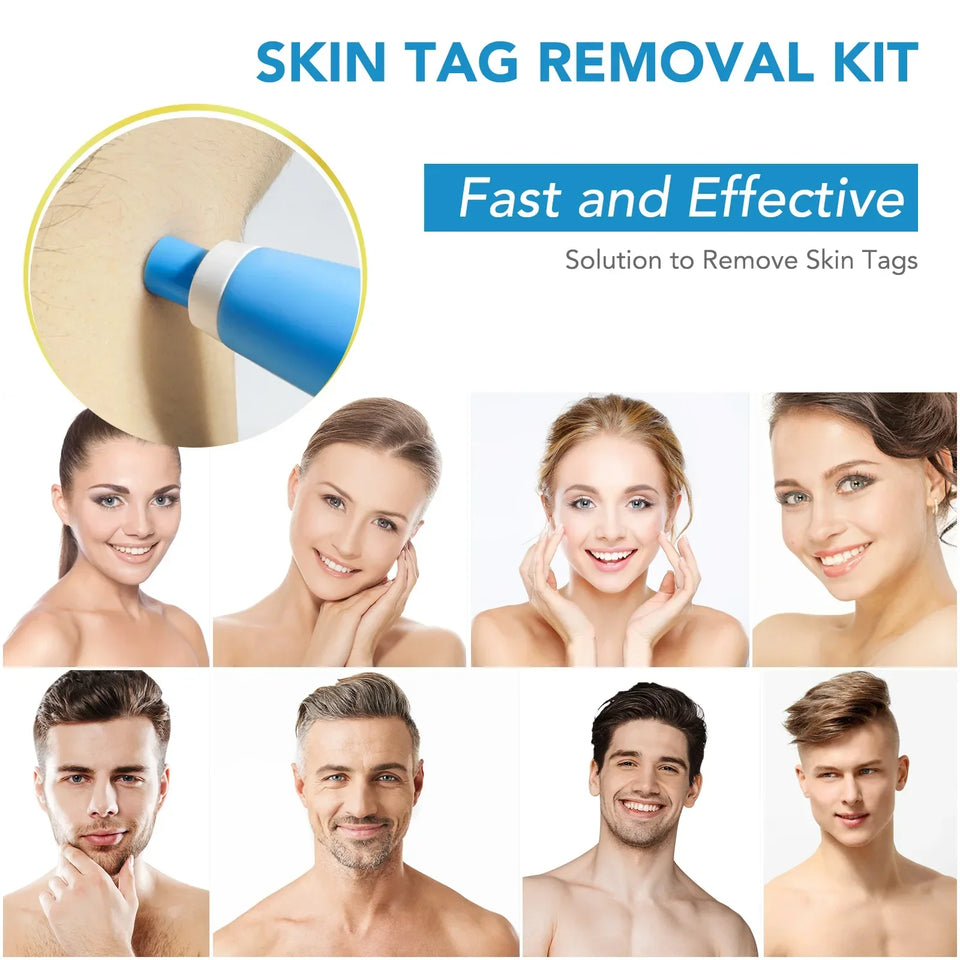 2 In 1 Auto Micro Skin Tag Remover Device Portable Skin Tag Removal Kit Adult Mole Stain Wart Corn Remover Face Care Beauty Tool