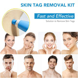 2 In 1 Auto Micro Skin Tag Remover Device Portable Skin Tag Removal Kit Adult Mole Stain Wart Corn Remover Face Care Beauty Tool