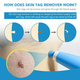 2 In 1 Auto Micro Skin Tag Remover Device Portable Skin Tag Removal Kit Adult Mole Stain Wart Corn Remover Face Care Beauty Tool